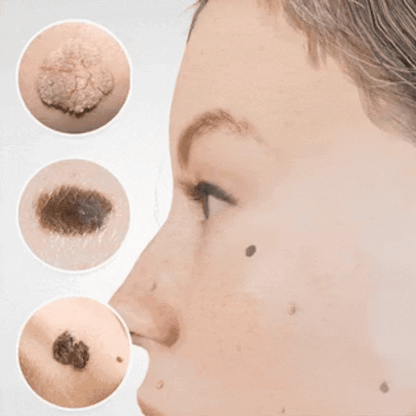 Lumévia™ | Pigmentkorrigerande Serum för Jämnare Hudton