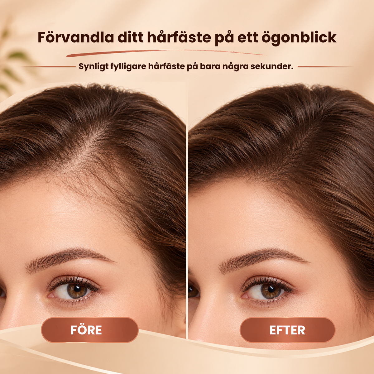 Rootelle™ | Dölj tunna partier och få en fylligare hårlinje på sekunder