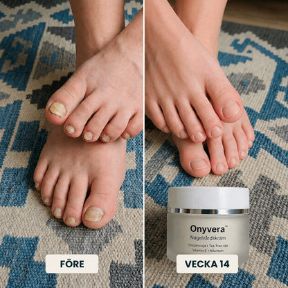 Onyvera™ | Synligt friskare naglar på ett enkelt sätt