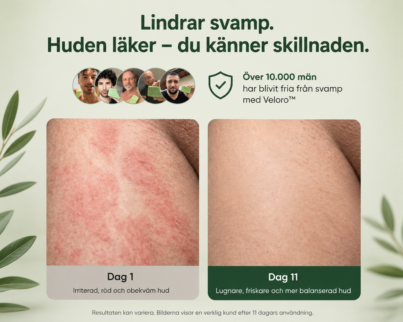 Veloro™ | Naturlig Tea Tree-tvål mot klåda & irritation