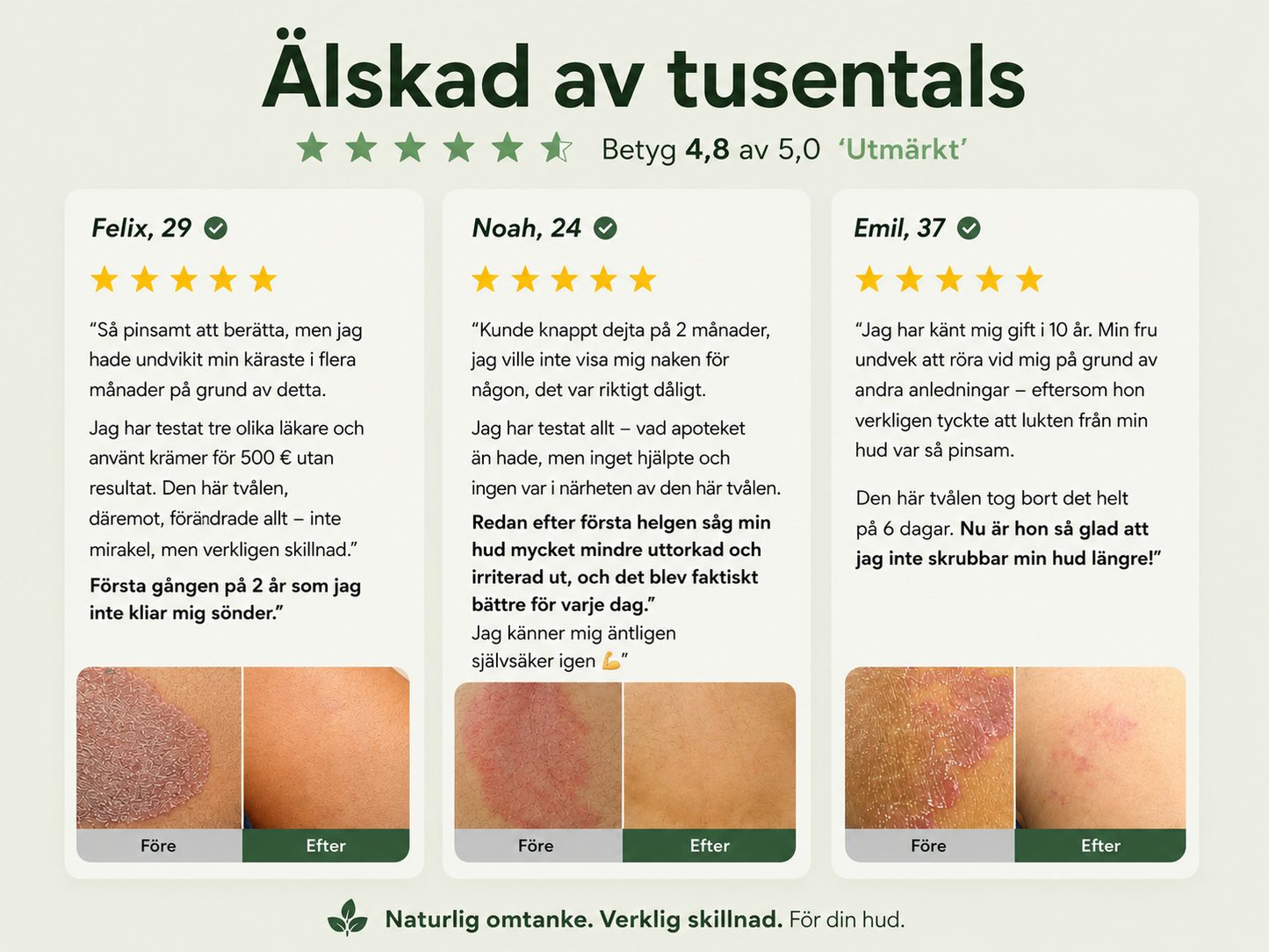 Veloro™ | Naturlig Tea Tree-tvål mot klåda & irritation