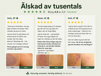 Veloro™ | Naturlig Tea Tree-tvål mot klåda & irritation