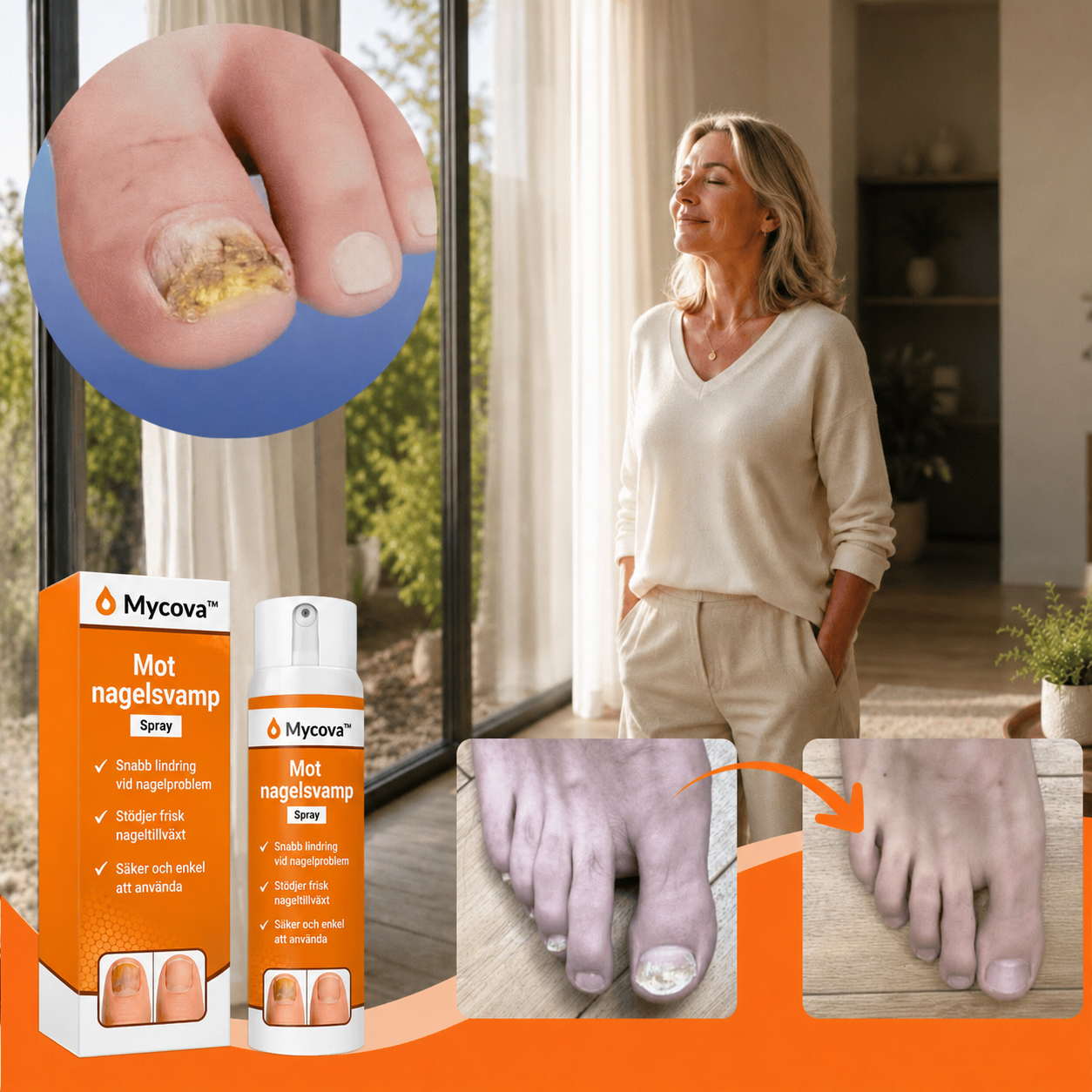 Mycova™ | Tar bort nagelsvamp och återställer friska naglar