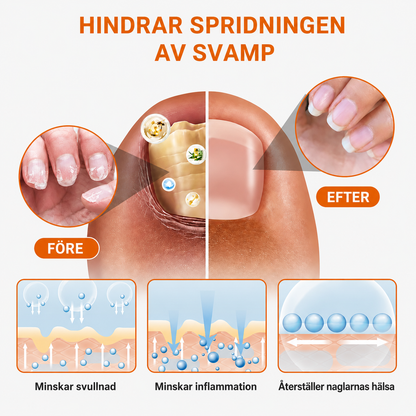 Mycova™ | Tar bort nagelsvamp och återställer friska naglar