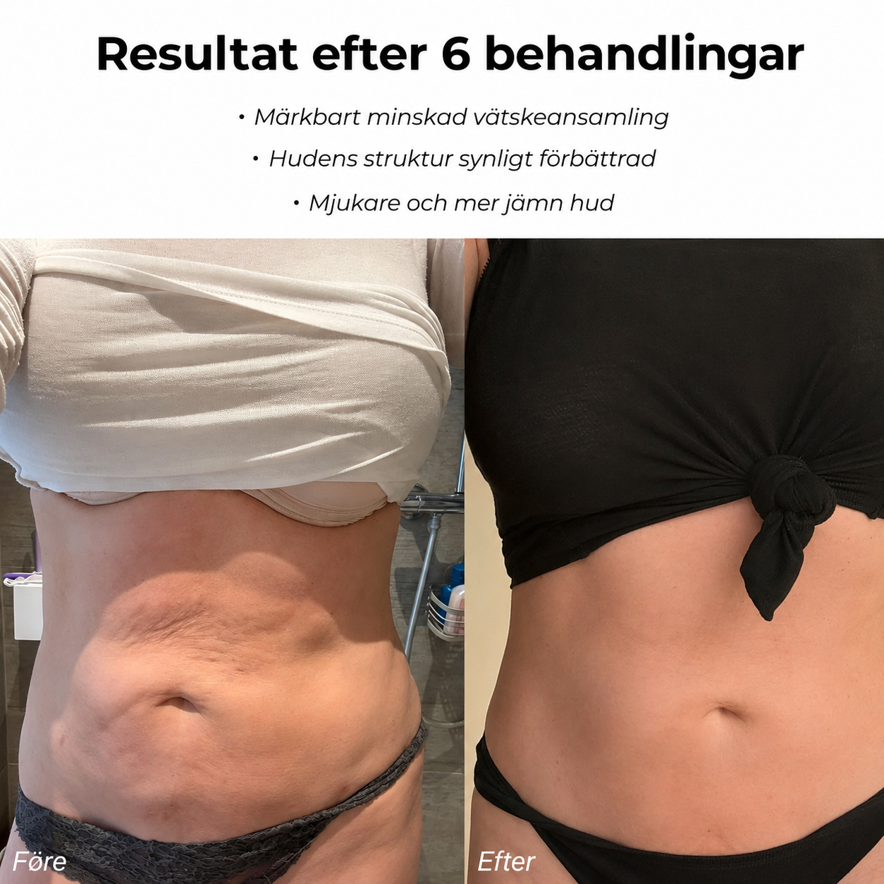 Silhouva™ | Kroppsformande Massagemaskin mot Celluliter