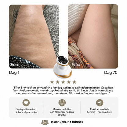 Silhouva™ | Kroppsformande Massagemaskin mot Celluliter