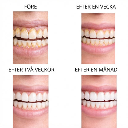 Denvia™ – Ultraljudsrengöring för tänderna