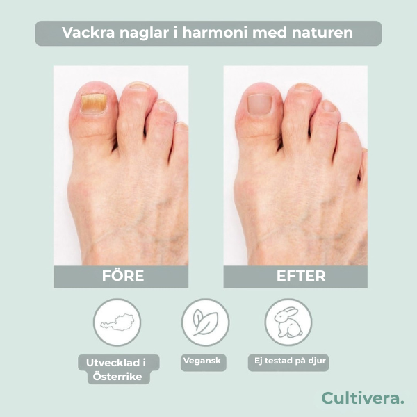 Cutivera™ | Närande Nagel- & Nagelbandsolja Penna