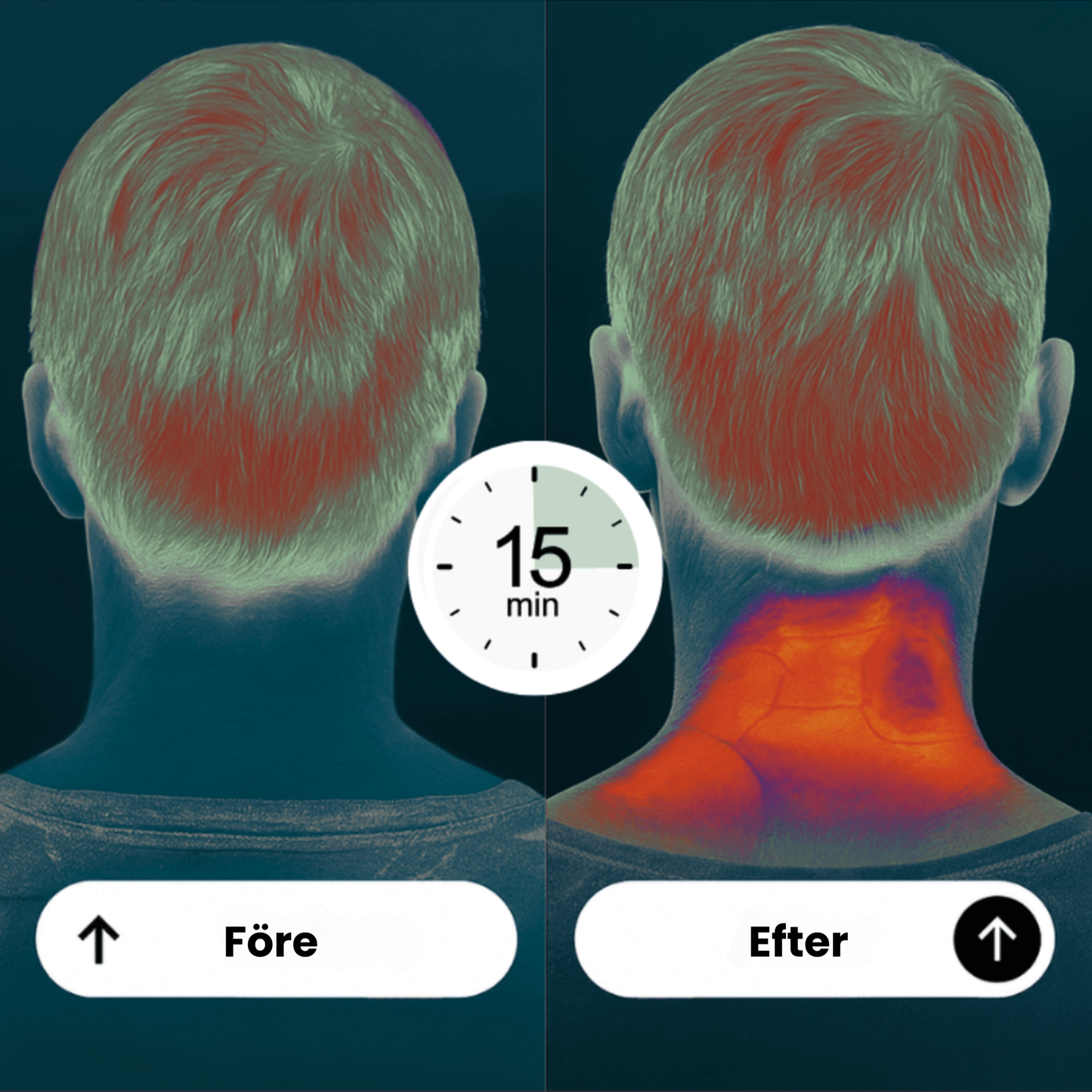 NUVANTA™ | Djup värme & avslappning för nacke och axlar