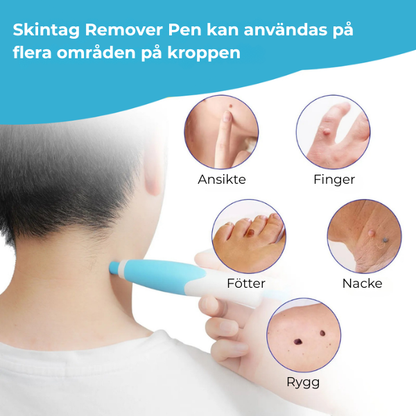 Skinvera™ | Skintag Remover Pen – Ta Bort Hudflikar Snabbt & Enkelt Hemma